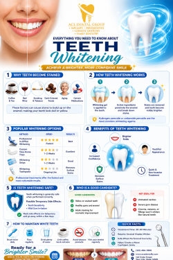 Everything You Need to Know About Teeth Whitening | Ace Dental Group