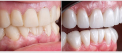 Emergency Dentist Warrawee: Fast and Reliable Care When Dental Emergencies Strike