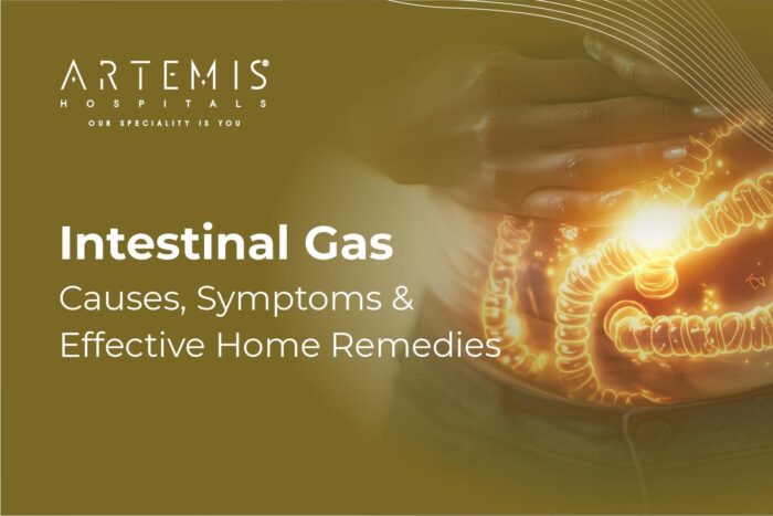 Intestinal Gas: Causes & Home Remedies For Quick Relief | Artemis Hospitals