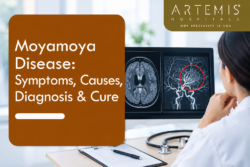 Moyamoya Disease: Symptoms, Causes, Warning Signs & Cure | Artemis Hospitals