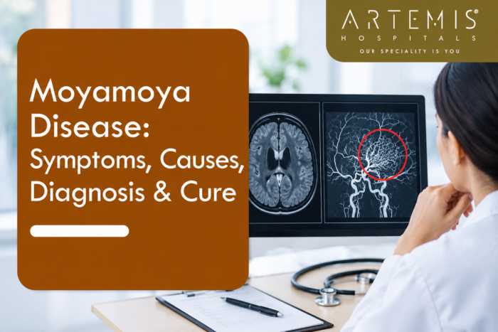 Moyamoya Disease: Symptoms, Causes, Warning Signs & Cure | Artemis Hospitals